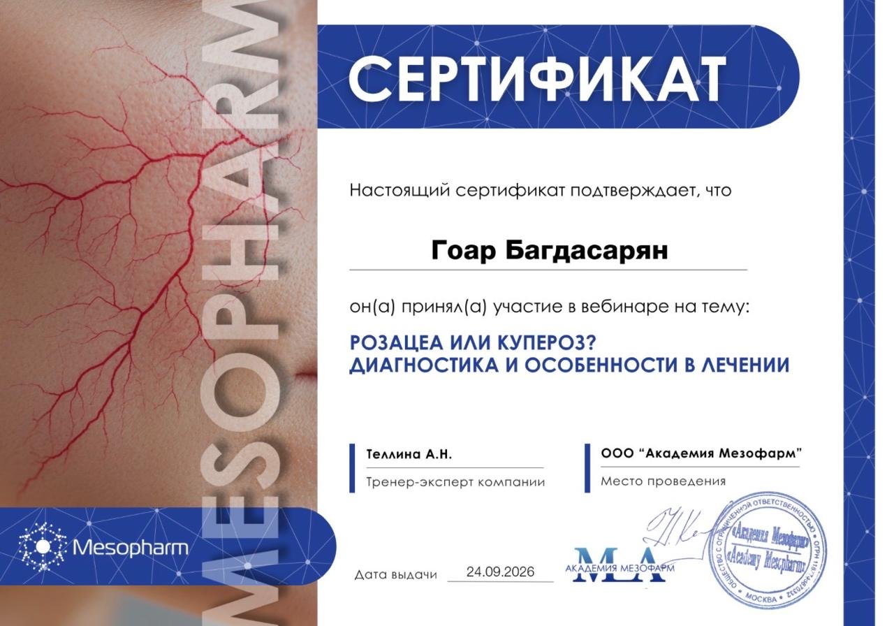 Розацеа или купероз? Диагностика и особенности в лечении